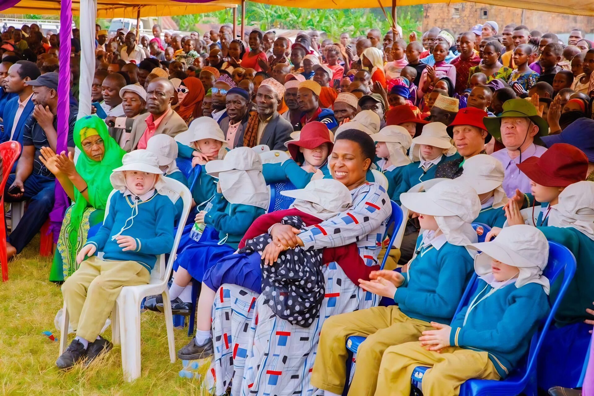 people with albinism